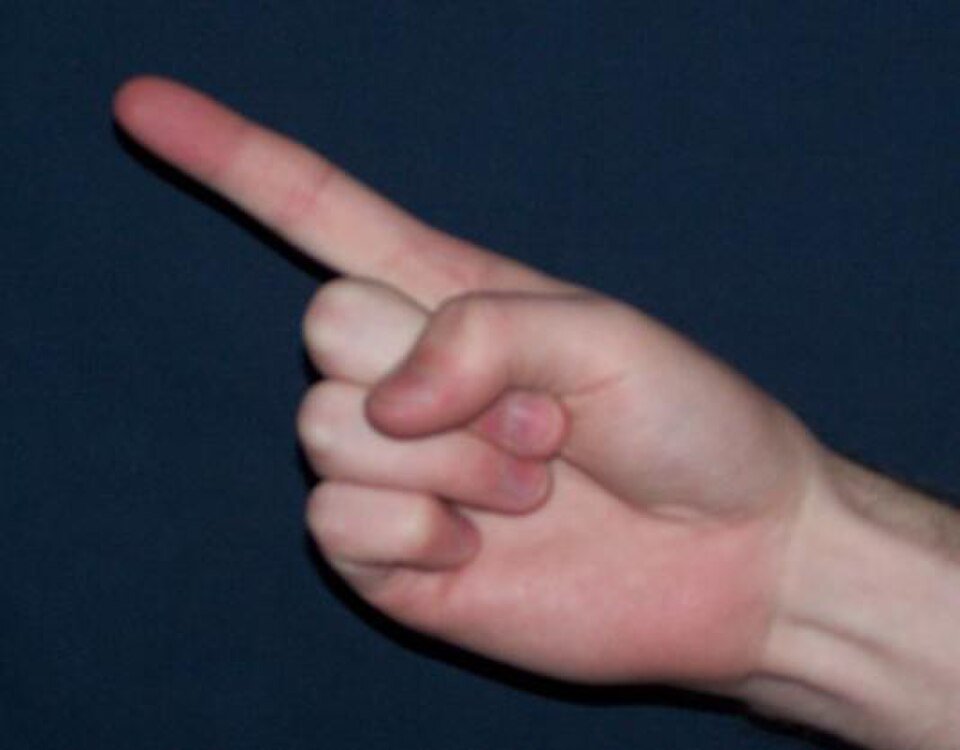 أنگۊشت (Finger)